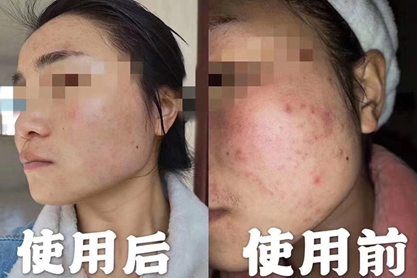 常見(jiàn)的護膚品“成分”解析-歐泉生化