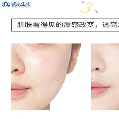 跟著(zhù)廠(chǎng)家了解毛孔堵塞的兩種癥狀